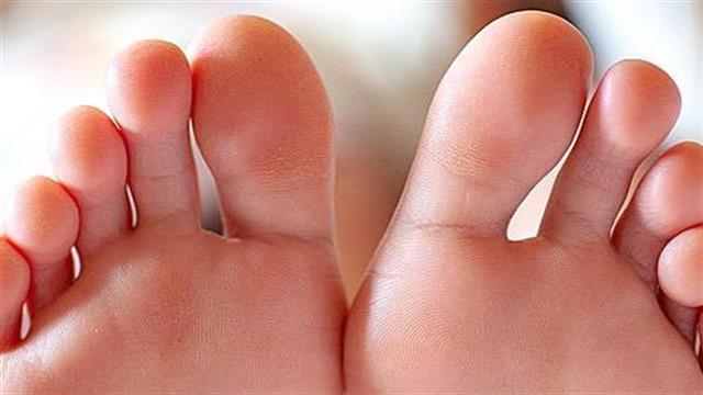 Πώς αντιμετωπίζεται το νευρίνωμα Morton΄s στο πέλμα