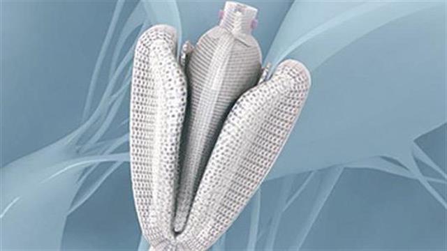 ΥΓΕΙΑ: Νέες θεραπευτικές δυνατότητες για τη θεραπεία ασθενών με πρόβλημα στην τριγλώχινα βαλβίδα της καρδιάς