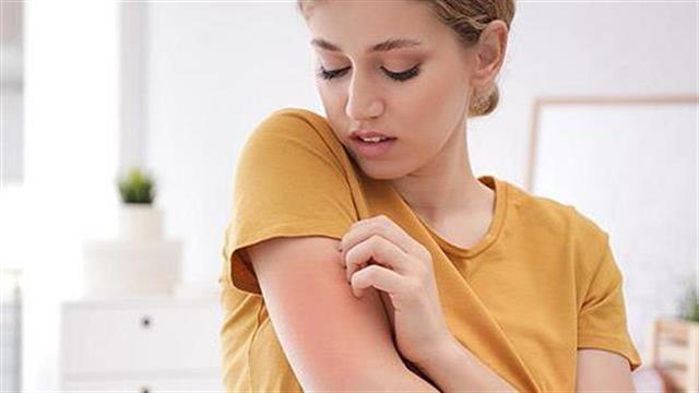 Νέες θεραπείες για την ατοπική δερματίτιδα δίνουν λύση σε άλυτα προβήματα!