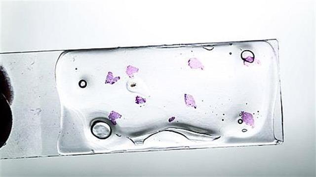 Ποιο είναι το έργο του παθολογοανατόμου;