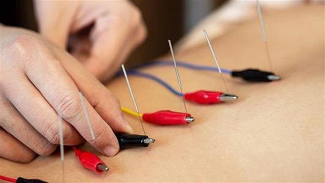 Ηλεκτροβελονισμός: μικρή επίδραση στον πόνο της πλάτης