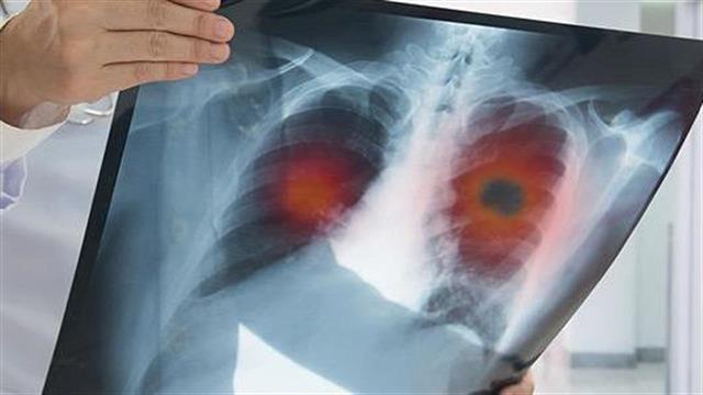 Μείωση της βλάβης από το κάπνισμα