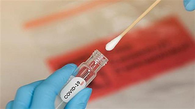 Προς αναστολή τεστ COVID-19 από ιδιωτικά διαγνωστικά εργαστήρια