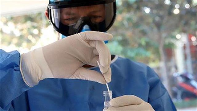 Μείωση λοιμώξεων - αύξηση θανάτων: 904 νέα κρούσματα και 101 ακόμη θάνατοι