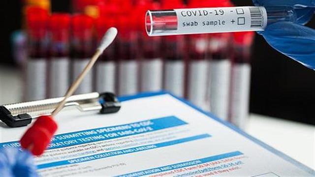 Οι λόγοι που οδήγησαν στην αύξηση του πλαφόν στα τεστ για κορωνοϊό