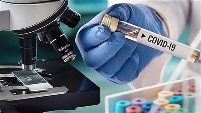 Ανεξήγητα μεγάλη μείωση στα τεστ κορωνοϊού