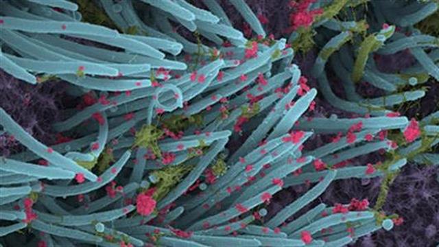 Εικόνα του SARS-CoV-2 να προσβάλλει τα κύτταρα του αναπνευστικού [φωτογραφίες]