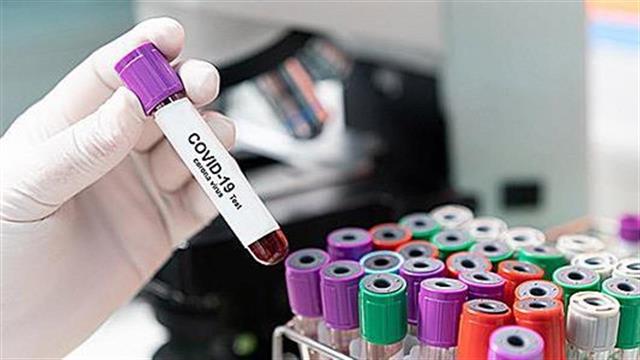 CureVac και Bayer ενώνουν τις δυνάμεις στη μάχη κατά της COVID-19 με το υπό έρευνα εμβόλιο CVnCoV