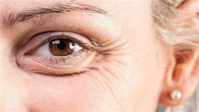 7 επιστημονικά αποδεδειγμένοι τρόποι για να αποφύγετε τις ρυτίδες