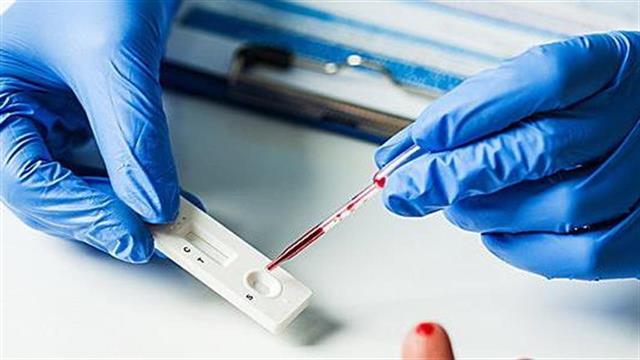 Έρευνα της Επιτροπής Ανταγωνισμού στις αγορές τεστ ανίχνευσης του κορωνοϊού