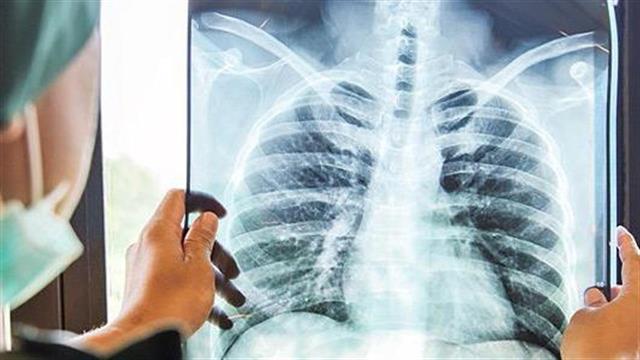 Πανελλήνιος Ιατρικός Σύλλογος : Ανάγκη πρόληψης και έγκαιρης διάγνωσης των νέων περιστατικών καρκίνου εν μέσω πανδημίας