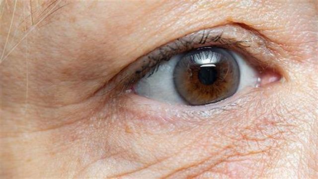 Δώρο ζωής από τη δεύτερη μεταμόσχευση κερατοειδούς στη  Β’ Οφθαλμολογική Κλινική ΑΠΘ στο Γ.Ν. Παπαγεωργίου