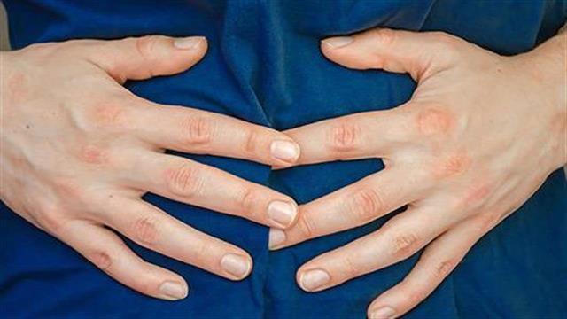 Σύνδρομο ευερέθιστου εντέρου – ένα βήμα πιο κοντά στη διαχείριση