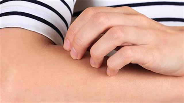 Δερματίτιδα: Συχνή δερματολογική πάθηση