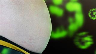 Οι 3 σοβαρές επιπτώσεις της παχυσαρκίας στην CoViD-19