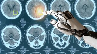 Η Τεχνητή Νοημοσύνη στη μάχη κατά του καρκίνου με τη συνδρομή επιστημονικής ομάδας του ΑΠΘ