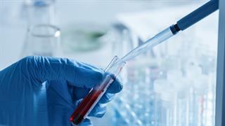 Ημέρα Υγείας: Check up με μειωμένη τιμή από τις υποδομές Υγείας της INTERAMERICAN