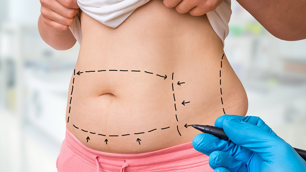 Λίπος: Πώς συμβάλλει στην…ομορφιά;