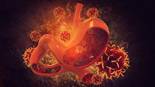 Καρκίνος στομάχου: Ποιο είναι το “κλειδί” της θεραπείας;