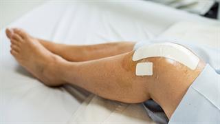 Ανακάλυψη στην αναγέννηση του δέρματος θα μπορούσε να σηματοδοτήσει τεράστια πρόοδο στην πλαστική χειρουργική