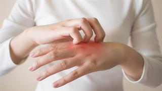 Συμφωνία  Amgen με Kyowa Kirin