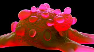 Καρκίνος ουροδόχου κύστης: Η ανοσοθεραπεία μειώνει ενδεχομένως την υποτροπή