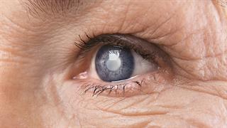 Επέμβαση καταρράκτη: Μύθοι και πραγματικότητα