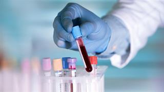 Νέα εξέταση αίματος για τη διάγνωση της μετωποκροταφικής άνοιας