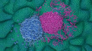 Εγκρίθηκε επικουρική θεραπεία για ασθενείς με καρκίνο του οισοφάγου