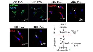 Βλάβες στο DNA προκαλούν χρόνια φλεγμονή και παγκρεατίτιδα