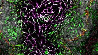 Ανακαλύφθηκε νέο γονίδιο που παίζει σημαντικό ρόλο στον τρόπο λειτουργίας του σπλήνα