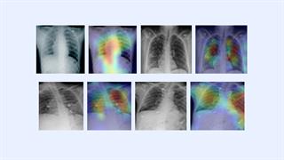 Καινοτόμα τεχνολογία τεχνητής νοημοσύνης μπορεί να διαγνώσει την COVID-19 σε λίγα λεπτά