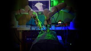 Eνα βήμα πιο κοντά στις εγχειρήσεις αποκλειστικά από ρομπότ