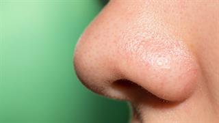 Bακτήριο στη μύτη μπορεί να αυξάνει τον κίνδυνο για Alzheimer