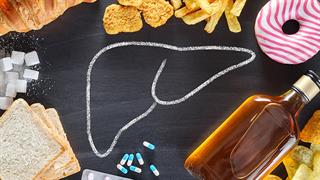 Λίπος στο συκώτι: Συμπτώματα, αίτια και θεραπεία