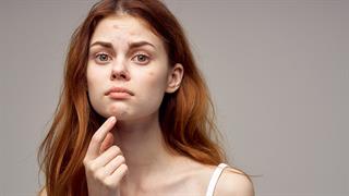 Διαβήτης: Τα προειδοποιητικά σημάδια στο δέρμα