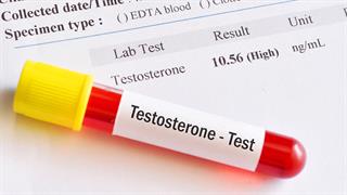 Χαμηλή τεστοστερόνη: Αιτίες, κίνδυνοι και λύσεις