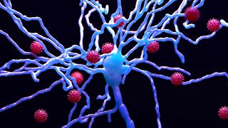 Νευρολογικά προβλήματα από βαριά νόσηση CoViD