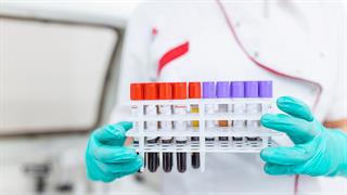 Η Ιαπωνία ενέκρινε kit εξέτασης αίματος για διάγνωση του Alzheimer