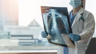 Η ΧΑΠ αυξάνει τον κίνδυνο θανάτου μετά από προγραμματισμένη χειρουργική επέμβαση 