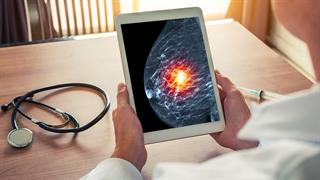 Γιατί ορισμένες γυναίκες εμφανίζουν καρκίνο και στους 2 μαστούς [μελέτη]