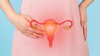 Νέα στοιχεία για τη σχέση ωορρηξίας και καρκίνου ωοθηκών 