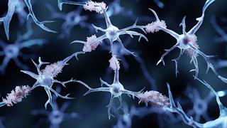 Θεραπεία  κατά της Αλτσχάιμερ συρρικνώνει τον εγκέφαλο