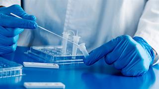  52 θάνατοι από CoViD, 61 διασωληνωμένοι - 14 κρούσματα της παραλλαγής 