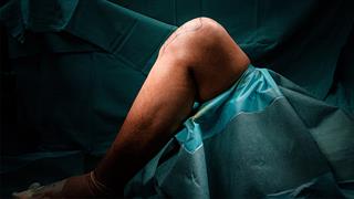 Επεμβάσεις στο γόνατο: Τι φοβούνται οι ασθενείς;