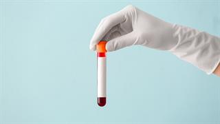 Εξέταση αίματος εντοπίζει 2 στους 3 καρκίνους