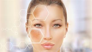 Μέλασμα: Τι είναι και τι το προκαλεί;