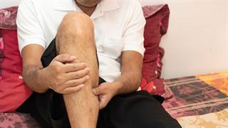 Περού:  Κατάσταση έκτακτης ανάγκης λόγω του συνδρόμου Guillain – Barré