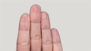 Γιατί ζαρώνουν τα χέρια μας στο νερό;