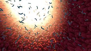 Τα βακτήρια του εντέρου συνδέονται με την απόφραξη των αρτηριών